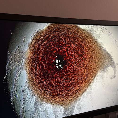 cell in microscope
