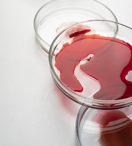 blood on trays